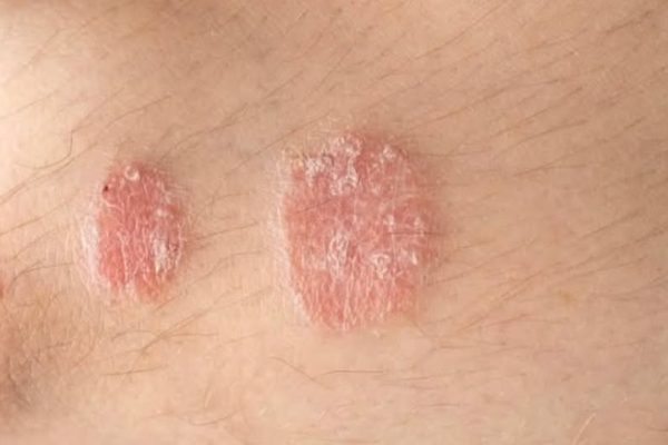 Warning signs you should never ignore on your skin